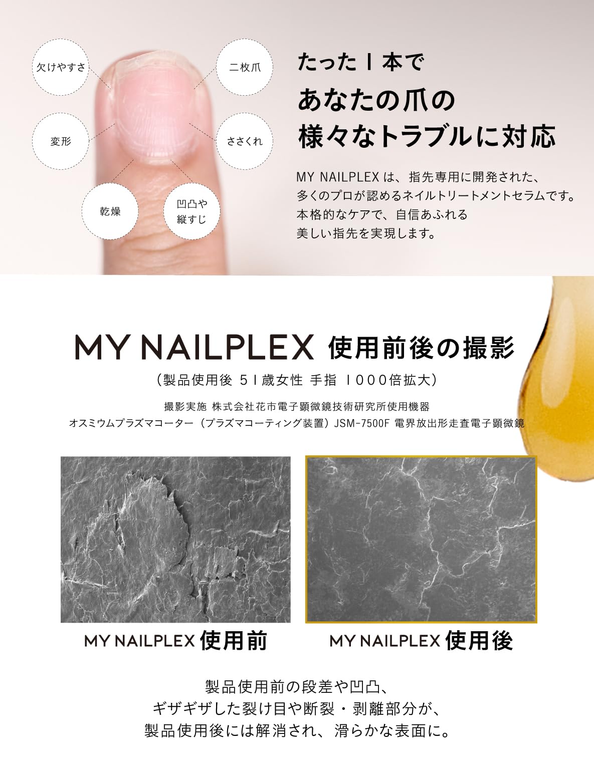 MYNAILPLEX マイネイルプレックス チタネイル ネイルケア美容液 10mL